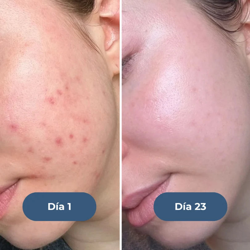 Piel antes y después